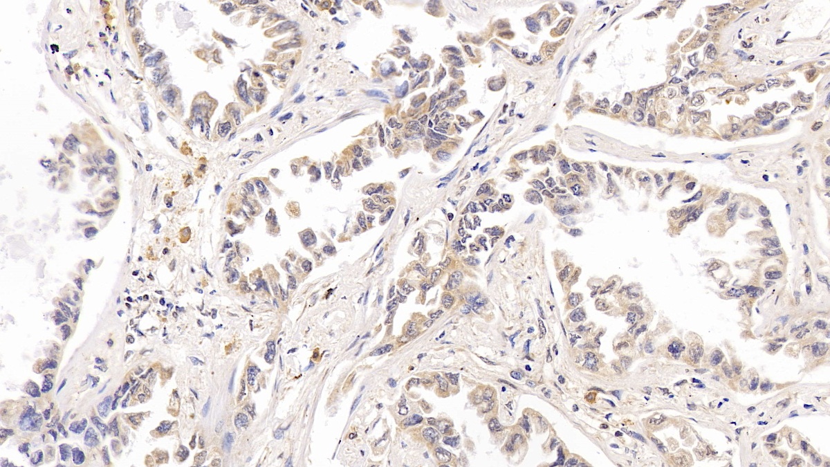 Polyclonal Antibody to Ribonucleotide Reductase M1 (RRM1)