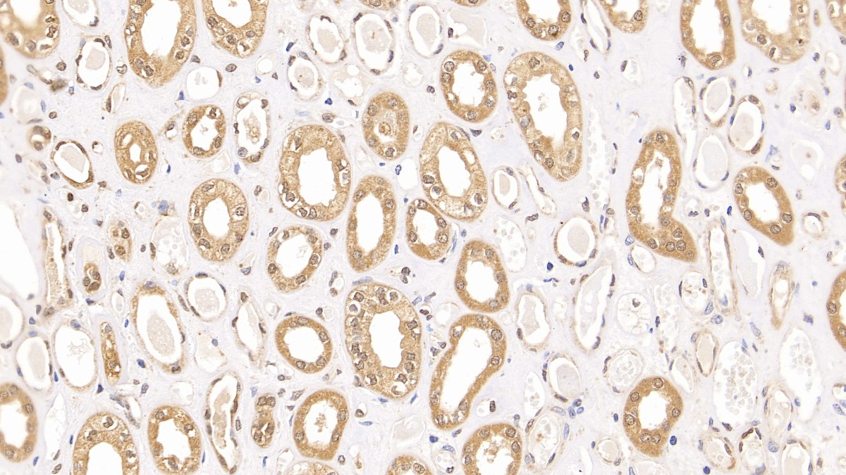 Polyclonal Antibody to Ribonucleotide Reductase M1 (RRM1)