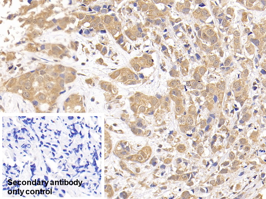 Polyclonal Antibody to Ribonucleotide Reductase M1 (RRM1)