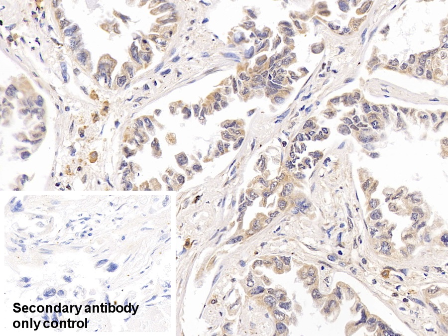 Polyclonal Antibody to Ribonucleotide Reductase M1 (RRM1)