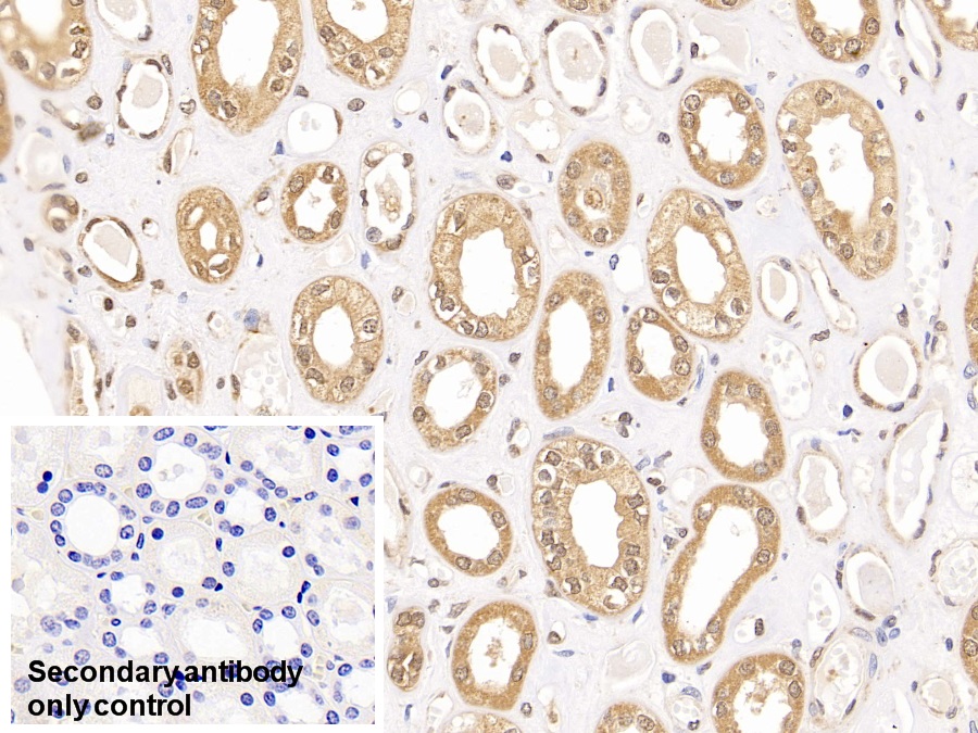 Polyclonal Antibody to Ribonucleotide Reductase M1 (RRM1)