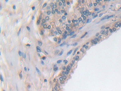 Polyclonal Antibody to Utrophin (UTRN)