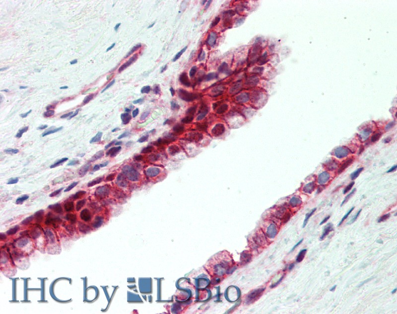 Polyclonal Antibody to Utrophin (UTRN)