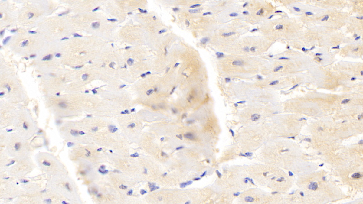 Polyclonal Antibody to Protoporphyrinogen Oxidase (PPOX)