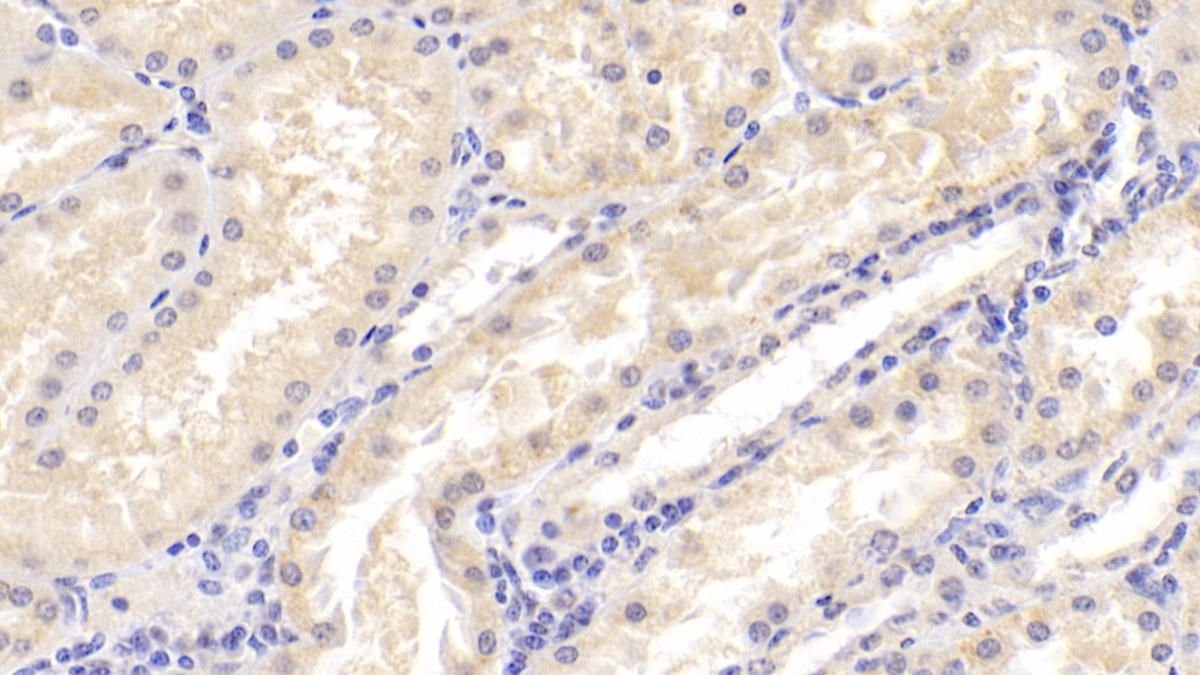 Polyclonal Antibody to Protoporphyrinogen Oxidase (PPOX)