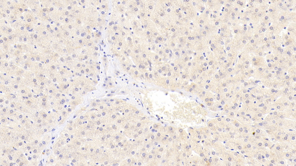 Polyclonal Antibody to Protoporphyrinogen Oxidase (PPOX)