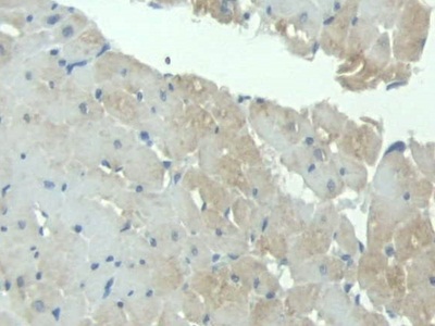 Polyclonal Antibody to Protoporphyrinogen Oxidase (PPOX)