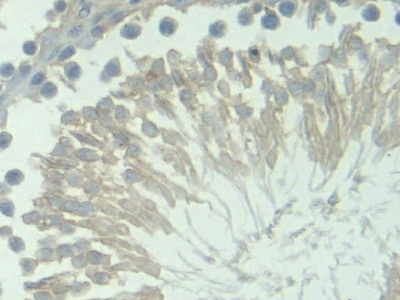 Polyclonal Antibody to Protoporphyrinogen Oxidase (PPOX)