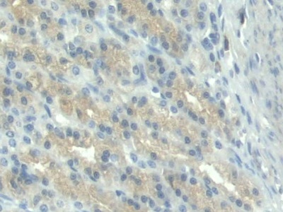 Polyclonal Antibody to Protoporphyrinogen Oxidase (PPOX)