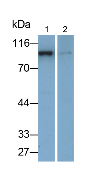 Polyclonal Antibody to Adenosine Monophosphate Deaminase 2 (AMPD2)