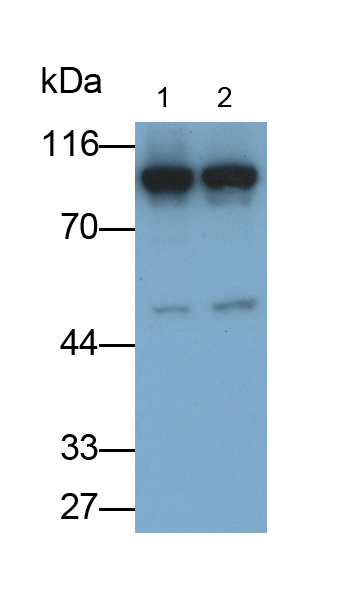 Polyclonal Antibody to Adenosine Monophosphate Deaminase 2 (AMPD2)