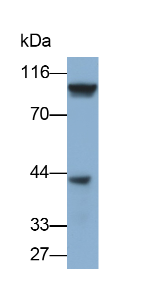 Polyclonal Antibody to Adenosine Monophosphate Deaminase 2 (AMPD2)