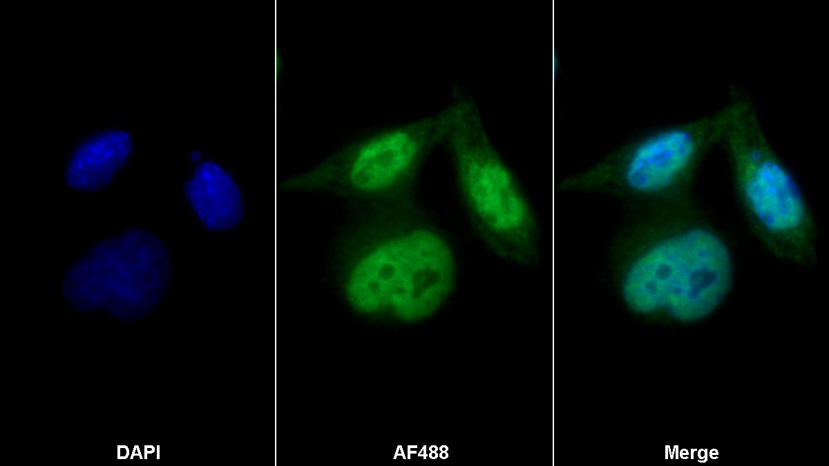 Polyclonal Antibody to G Protein Coupled Estrogen Receptor 1 (GPER)