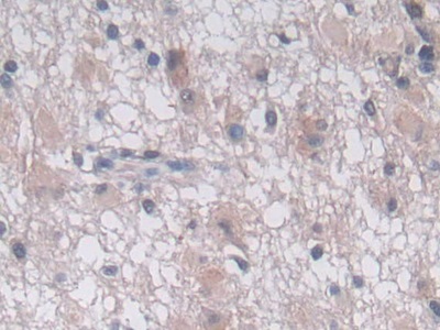 Polyclonal Antibody to Purinergic Receptor P2Y, G Protein Coupled 14 (P2RY14)