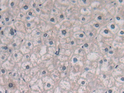 Polyclonal Antibody to Purinergic Receptor P2Y, G Protein Coupled 14 (P2RY14)