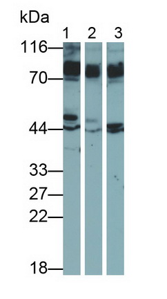 Polyclonal Antibody to Amyloid Beta Precursor Like Protein 1 (APLP1)