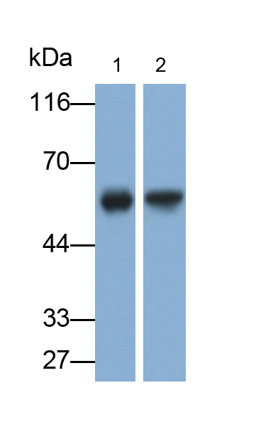 Polyclonal Antibody to Histidyl tRNA Synthetase 2, Mitochondrial (HARS2)