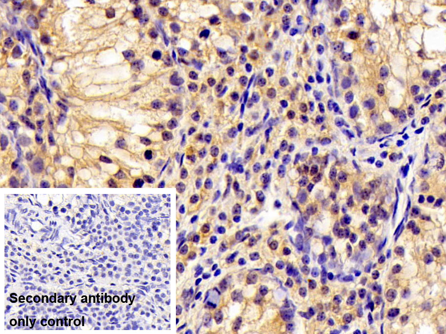 Polyclonal Antibody to Tyrosyl tRNA Synthetase 2, Mitochondrial (YARS2)