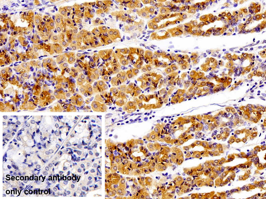 Polyclonal Antibody to Tyrosyl tRNA Synthetase 2, Mitochondrial (YARS2)