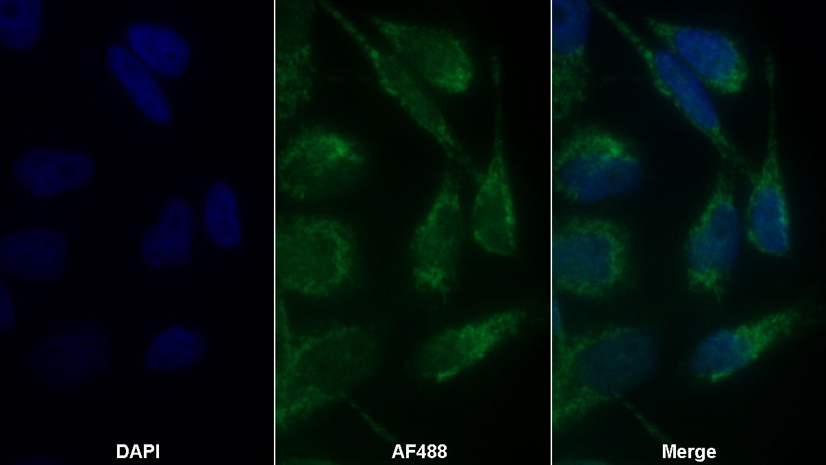 Polyclonal Antibody to Tyrosyl tRNA Synthetase 2, Mitochondrial (YARS2)