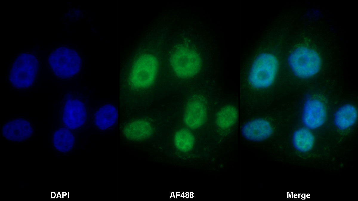 Polyclonal Antibody to X-Ray Repair Cross Complementing 1 (XRCC1)