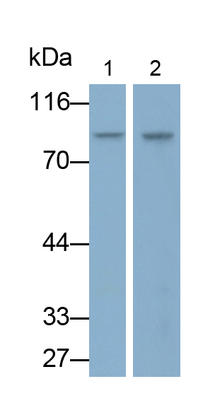 Polyclonal Antibody to X-Ray Repair Cross Complementing 1 (XRCC1)