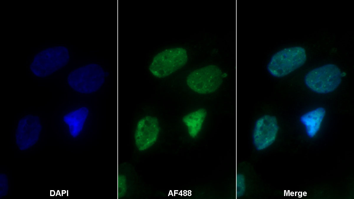 Polyclonal Antibody to Small Ubiquitin Related Modifier Protein 2 (SUMO2)