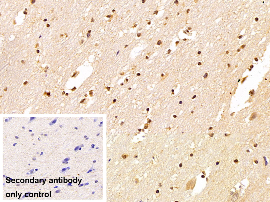 Polyclonal Antibody to Small Ubiquitin Related Modifier Protein 2 (SUMO2)