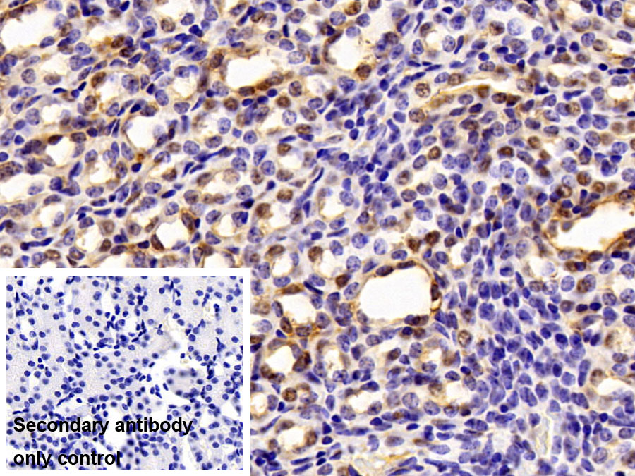 Polyclonal Antibody to Small Ubiquitin Related Modifier Protein 2 (SUMO2)