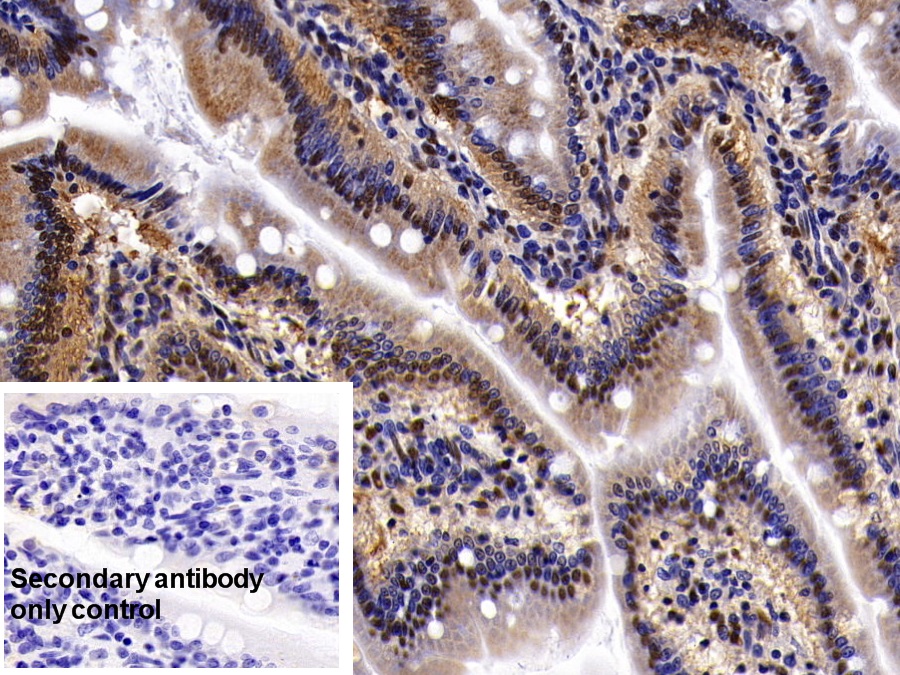 Polyclonal Antibody to Ubiquitin Like Modifier Activating Enzyme 2 (UBA2)