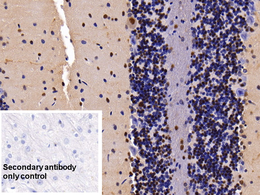 Polyclonal Antibody to Ubiquitin Like Modifier Activating Enzyme 2 (UBA2)