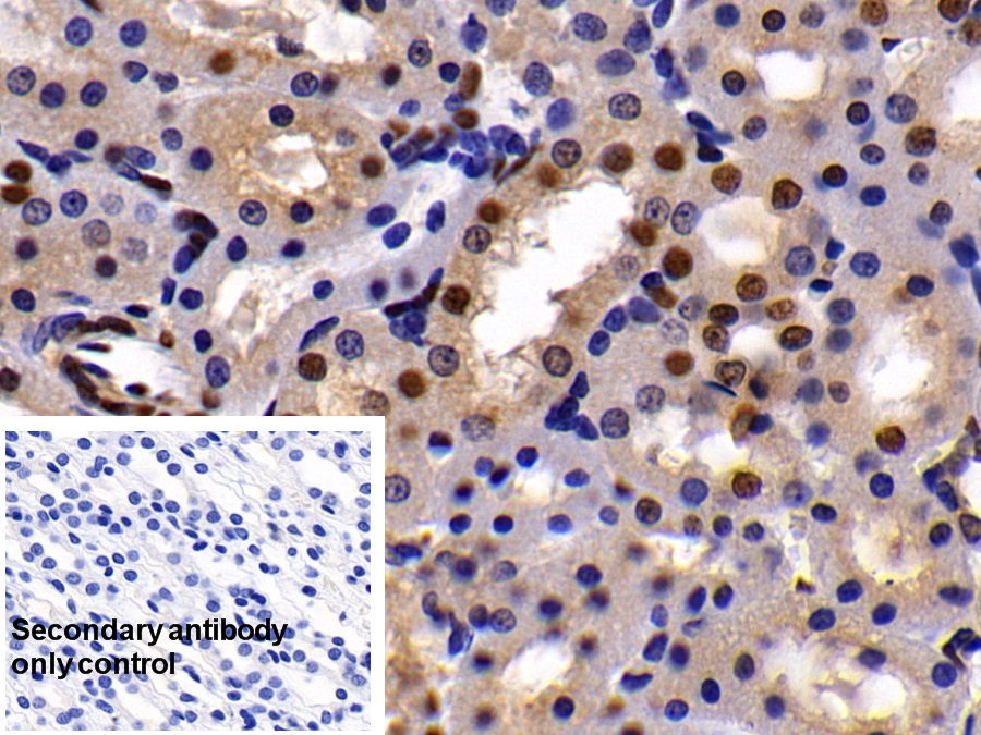 Polyclonal Antibody to Ubiquitin Like Modifier Activating Enzyme 2 (UBA2)