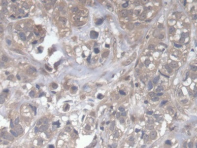 Polyclonal Antibody to Dedicator Of Cytokinesis 4 (DOCK4)