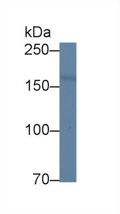 Polyclonal Antibody to Dedicator Of Cytokinesis 4 (DOCK4)