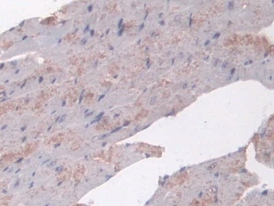 Polyclonal Antibody to N-Acetyltransferase 1 (NAT1)