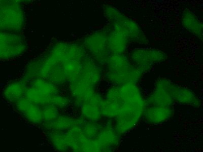 Polyclonal Antibody to N-Acetyltransferase 1 (NAT1)