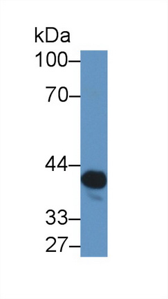 Polyclonal Antibody to N-Acetyltransferase 2 (NAT2)