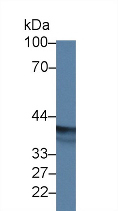 Polyclonal Antibody to Epithelial Stromal Interaction 1, Breast (EPSTI1)