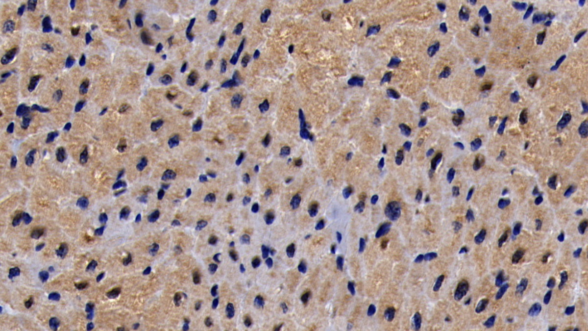 Polyclonal Antibody to Stromal Antigen 2 (STAG2)