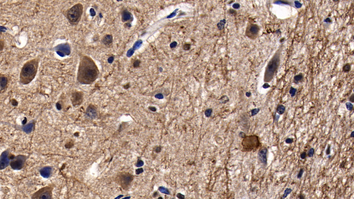 Polyclonal Antibody to Stromal Antigen 2 (STAG2)