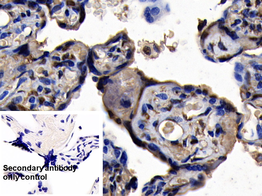 Polyclonal Antibody to Stromal Antigen 2 (STAG2)