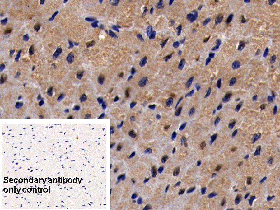 Polyclonal Antibody to Stromal Antigen 2 (STAG2)