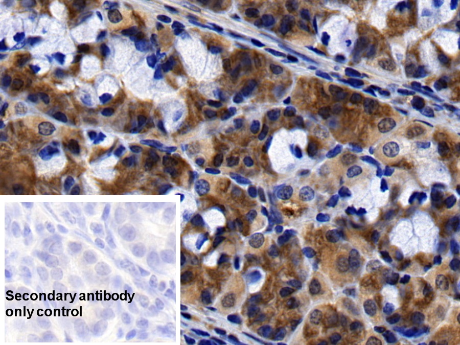 Polyclonal Antibody to Stromal Antigen 2 (STAG2)