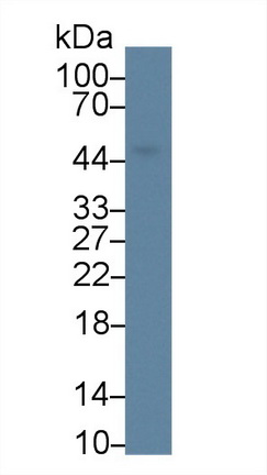 Polyclonal Antibody to Acylglycerol Kinase (AGK)