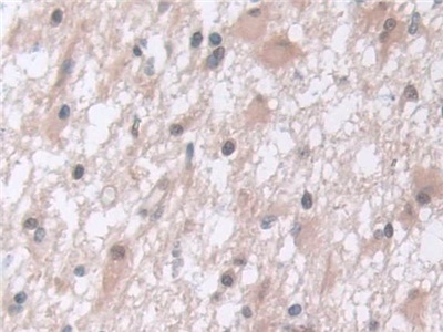 Polyclonal Antibody to Proteasome Subunit Alpha Type 5 (PSMa5)