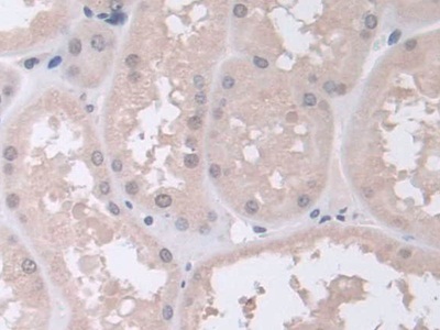 Polyclonal Antibody to Proteasome Subunit Alpha Type 5 (PSMa5)