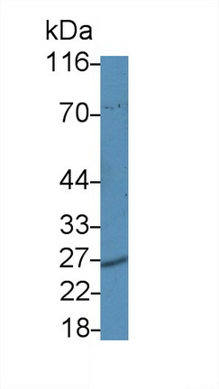 Polyclonal Antibody to Proteasome Subunit Alpha Type 5 (PSMa5)