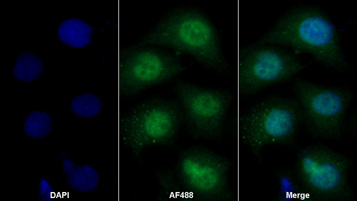 Polyclonal Antibody to Proteasome Subunit Alpha Type 7 (PSMa7)