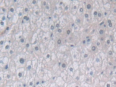 Polyclonal Antibody to Proteasome Subunit Beta Type 6 (PSMb6)