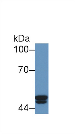 Polyclonal Antibody to Proteasome 26S Subunit, ATPase 4 (PSMC4)